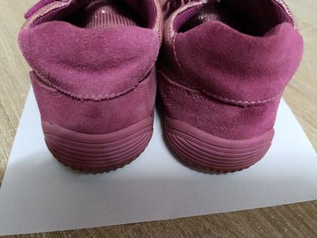 Protetika barefoot, protetika,35