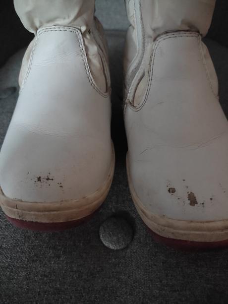 Teplé čižmy protetika, protetika,28