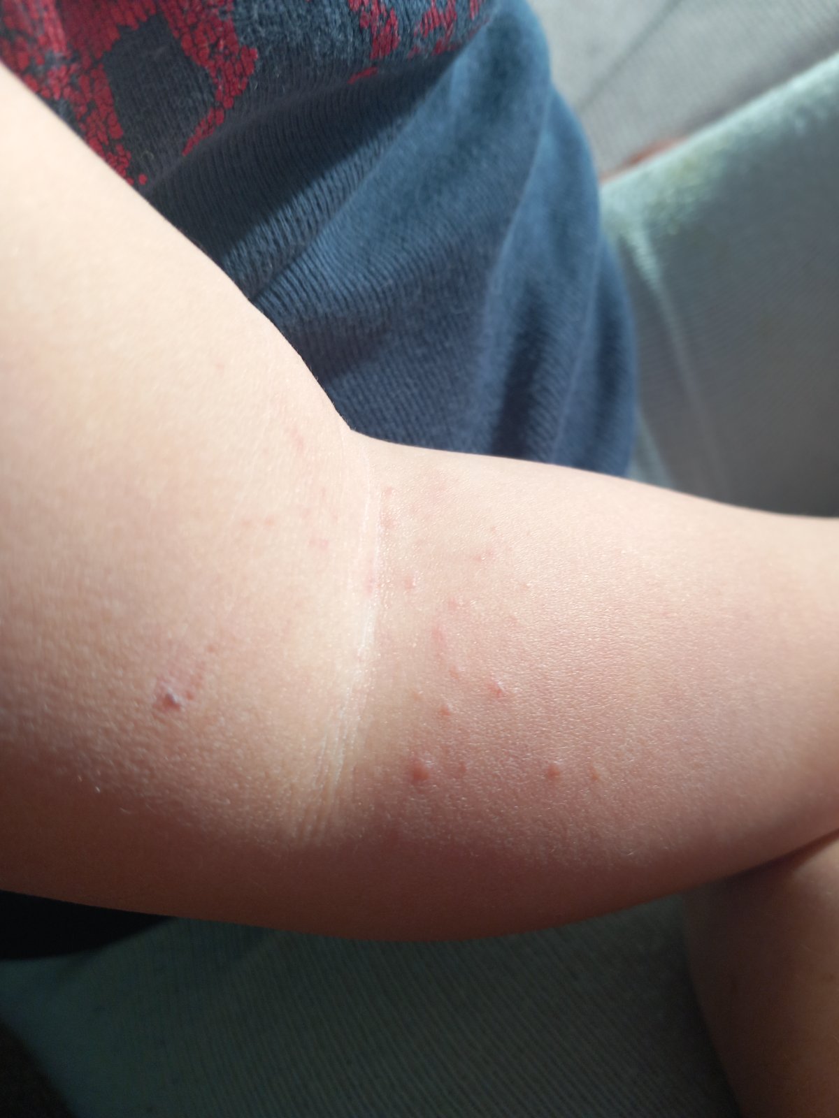 Je toto šiesta choroba? Modrý koník