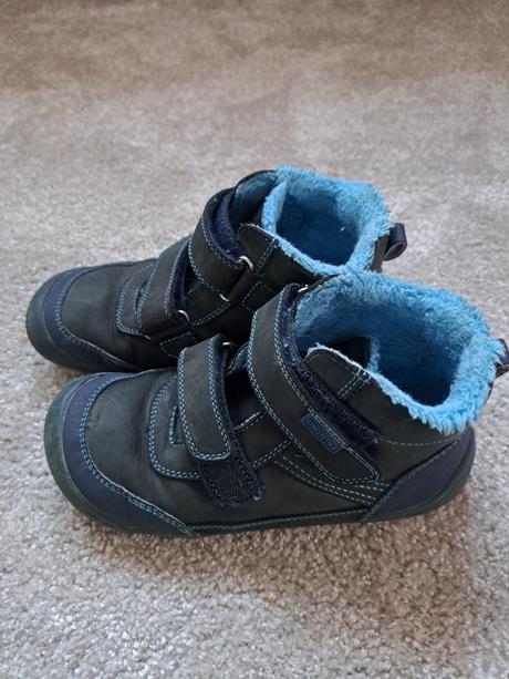 Zimne protetika barefoot, protetika,31