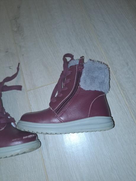 Zimne topanocky, protetika,24