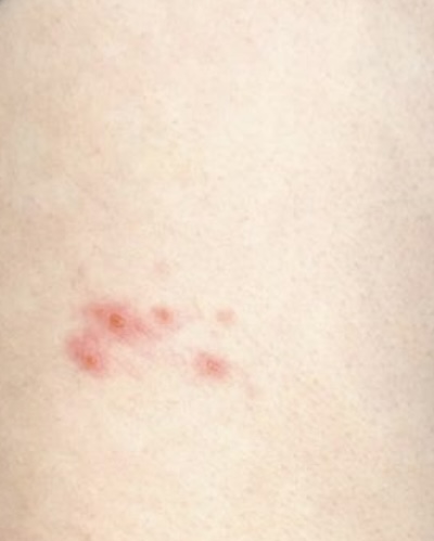 Čo su to za pupáky?