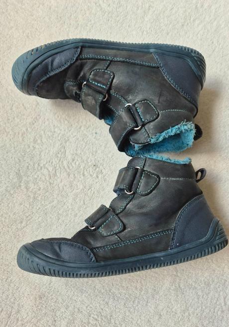 Protetika tyrel zimné 31, protetika,31