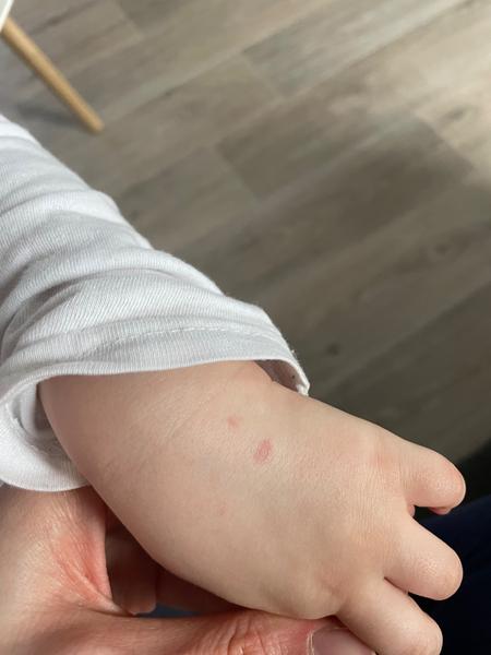 Odtlačky zubov od psa