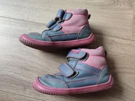 Protetika tyrel, protetika,25