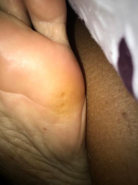 Čo to mám na nohe?