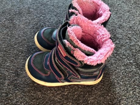 Zimne čižmy protetika, protetika,23