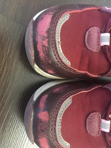 Topanky, protetika,31