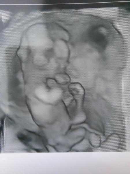 Bude to chlapček alebo dievčatko?