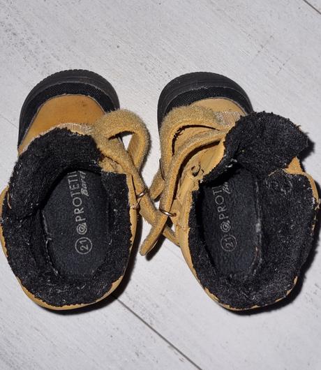 Protetika barefoot 21, protetika,21