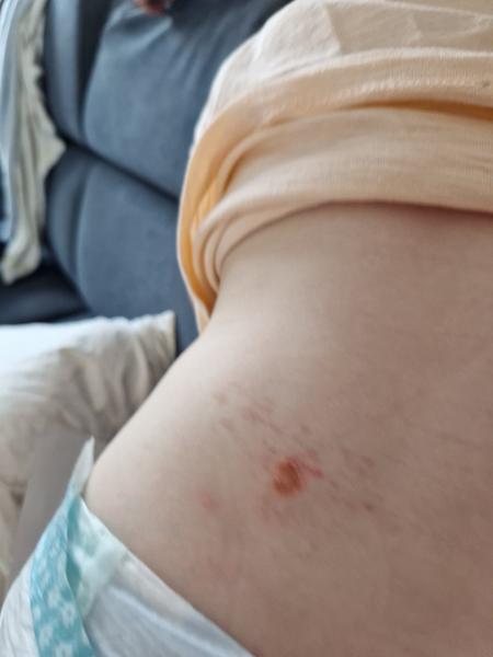 Čo to má 2-ročný syn na chrbte?