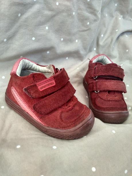 Topánočky, protetika,19