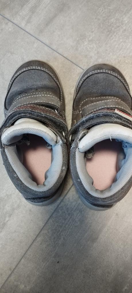 Protetika prechodné, protetika,27