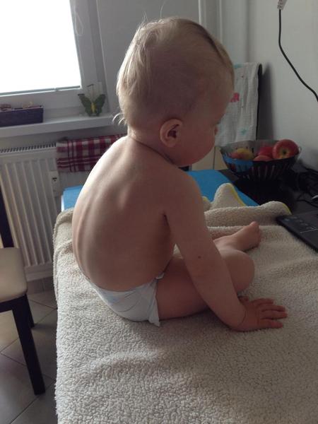 Vojtova metóda s ročným synom