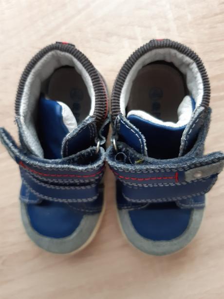 Topanky, protetika,21