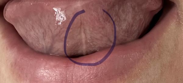 Čo to mám na jazyku?