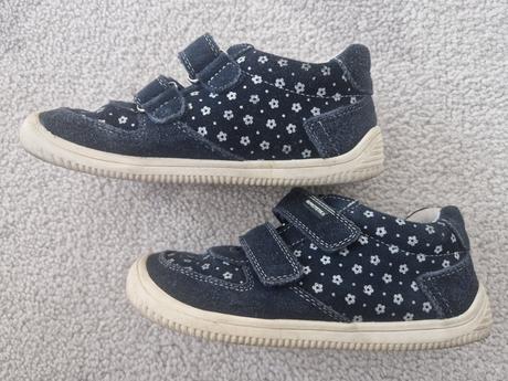 Topanky, protetika,32