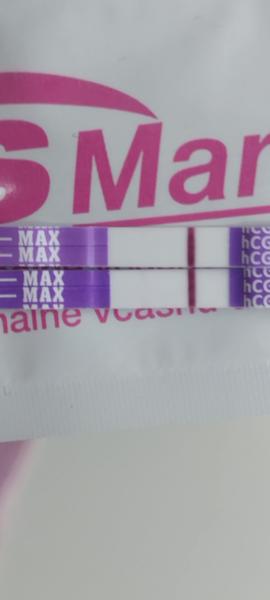 Ako správne interpretovať výsledky moču?