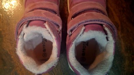 Protetika daxi pink, protetika,33