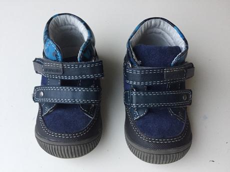 Prechodne topanky, protetika,19