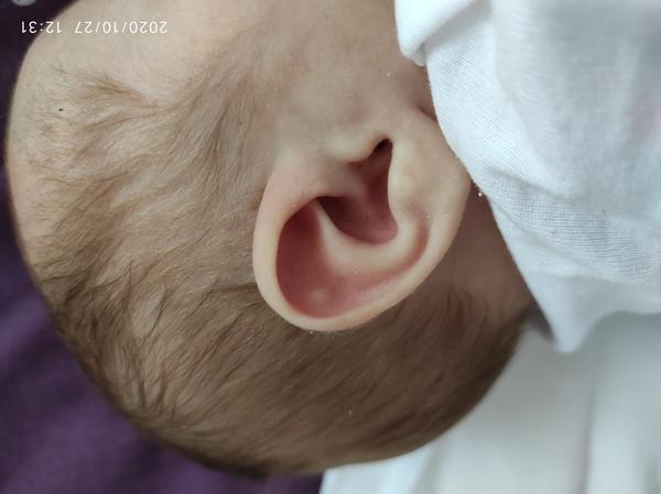 Čo to môže byť na synovom uchu?