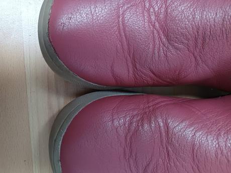 Protetika bf rada cizmicky, protetika,33