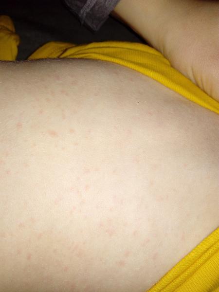 Syn mal teploty, vyhádzal sa, čo to môže byť ?