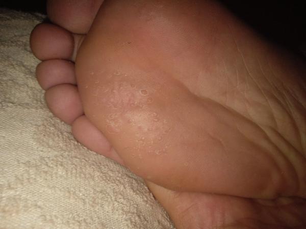 O aký kožný problém ide?