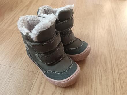 Protetika, protetika,21