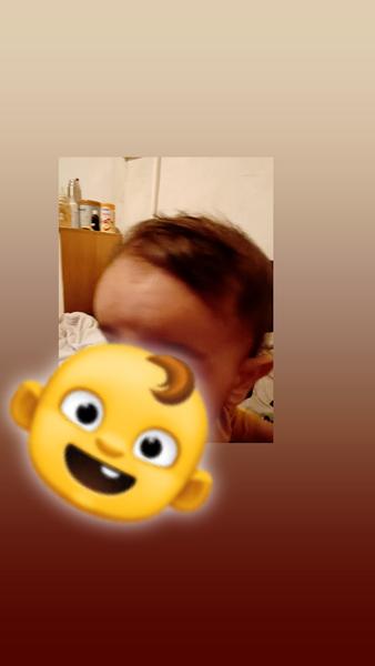 Hrča na čele dieťaťa: Čo to môže byť?