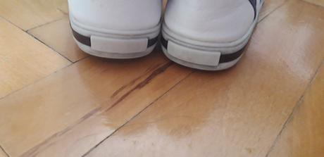 Kotnikove tenisky_ ob4, 31