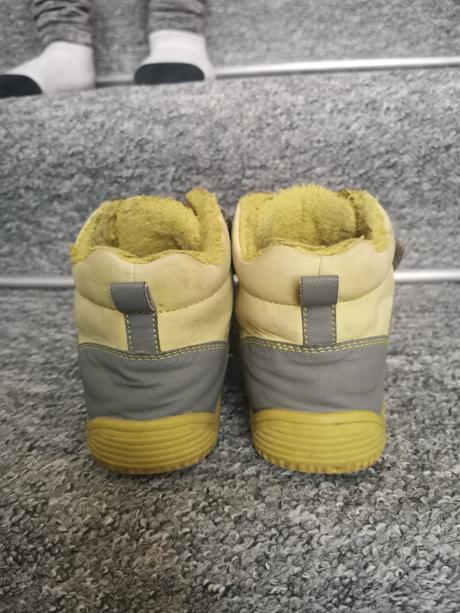 Protetika tyrel 32, protetika,32