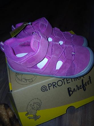 Nové proretika barefoot sandále, protetika,22 / 32