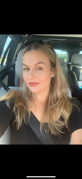 Prečo mi po pôrode vypadávajú vlasy?