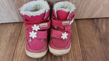 Zimne topánky protetika, protetika,19