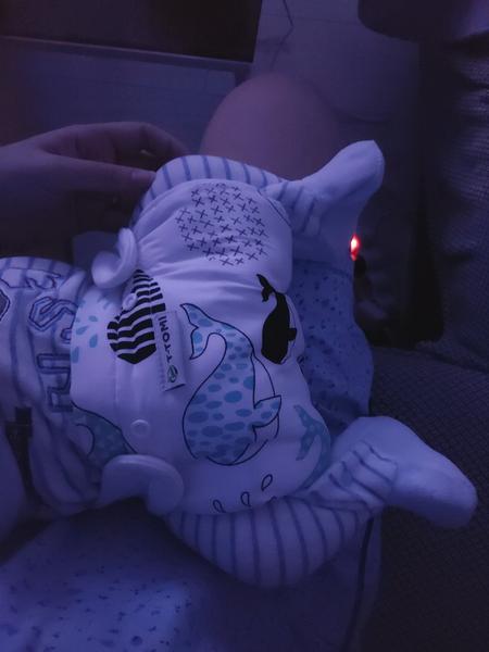 Je možné nahradiť abdukčnú perinku abdukčnými nohavičkami?