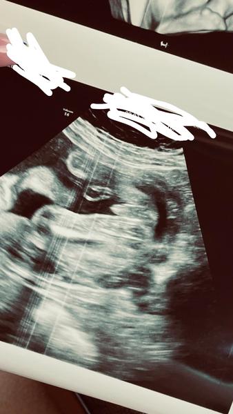 Je to chlapec či dievča?