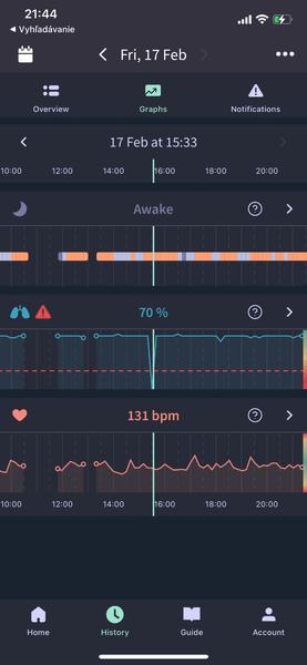 Môže saturácia rapídne klesnúť?