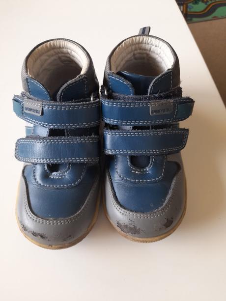 Topanky protetika, protetika,26