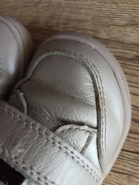 Protetika barefoot jarné topánky, protetika,23