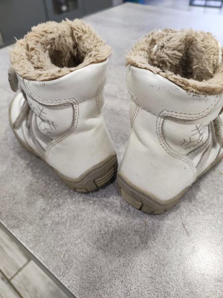 Čižmy protetika, protetika,22