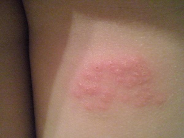 Čo sú tieto pľuzgieriky?