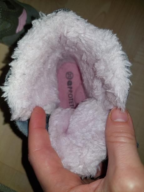 Protetika čižmičky, protetika,20