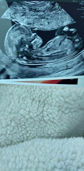 Čo čakáte? Chlapčeka alebo dievčatko?