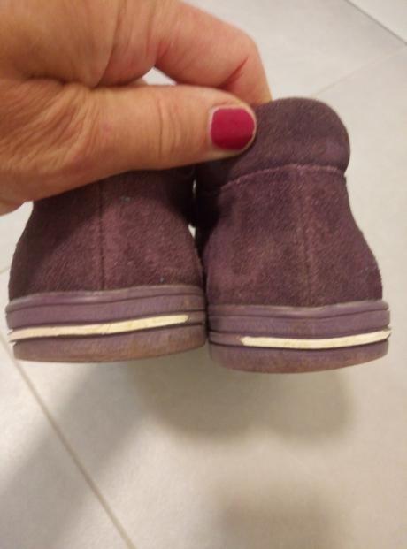 Topánky kožené, protetika,29