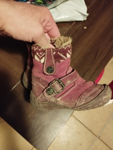 Čižmičky, protetika,20