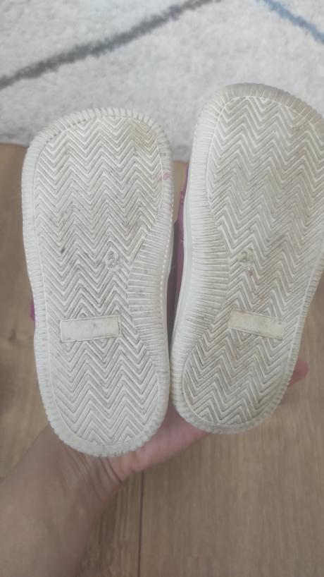 Celoročky protetika, protetika,24