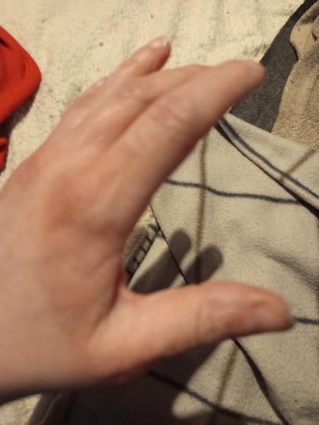 Začervenanie a svrbenie kože: Ako riešiť tento problém?