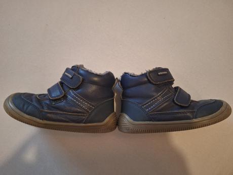 Protetika zimne, protetika,24