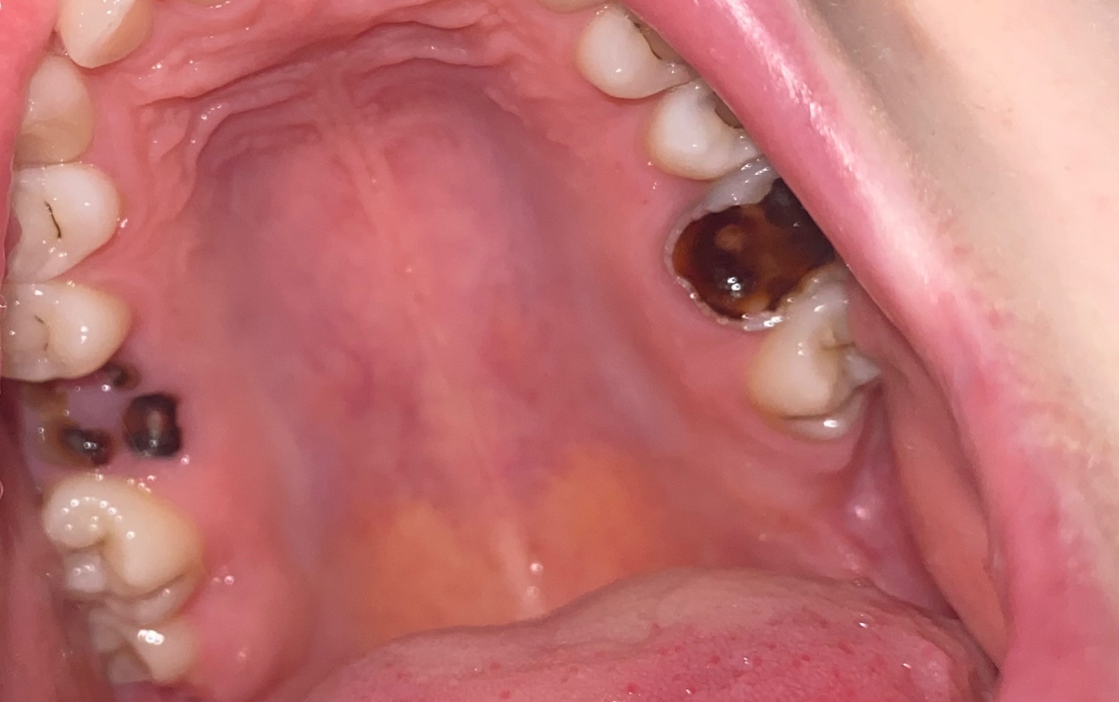 Mám hrozné zuby a bojím sa ísť k zubárovi Modrý koník